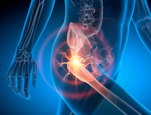 Hip Pain Relief with Robotic Physical Therapy